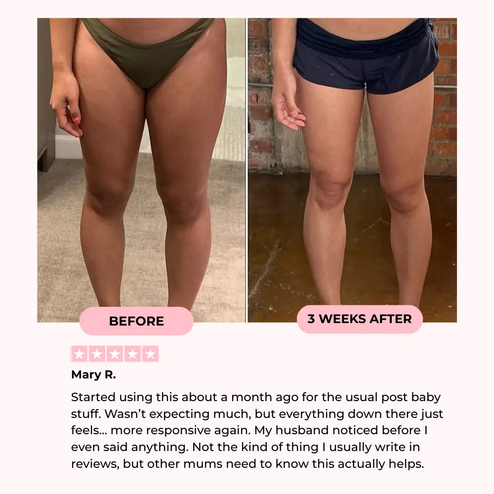 Mira Fit™ Thigh & Pelvic Trainer Mira