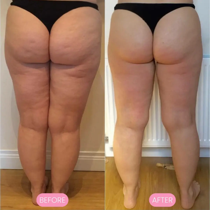 Mira™ Deep Tissue Massage Roller Mira